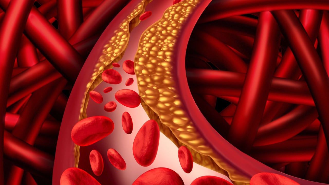 تقليل نسبة الكولسترول في الدم
